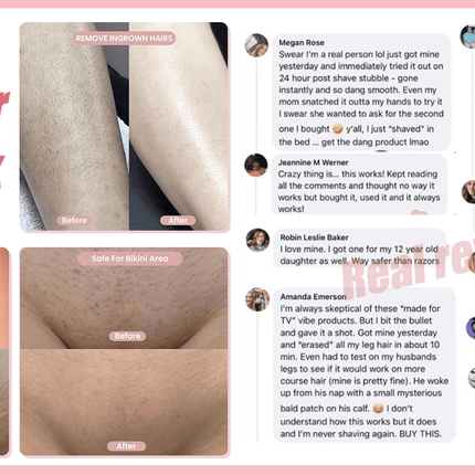 Rechargeable Electric Trimmer for Women 2in1 Hypoallergenic Electric Lady Hair Groomer Hair Removal Tool Body Shavers Gifts