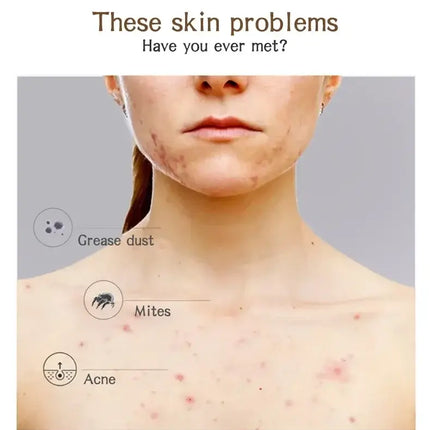 Natural African Black Soap with Organic Shea Butter Acne Treatment Anti-Blemish Moisturizing Body Face Skin Care Beauty Bath Bar