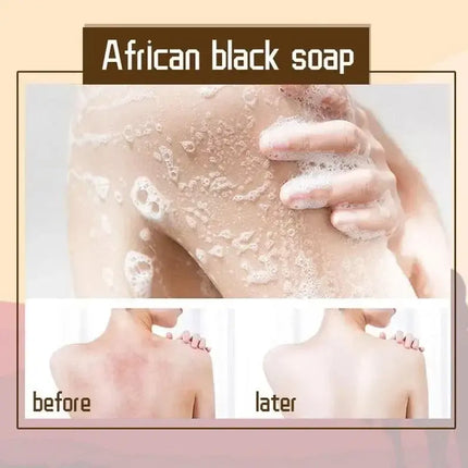 100g African Black Soap Natural Bath Body Treatment Acne Skin Care Magic Anti Rebelles Beauty Moisturizing Shea Butter